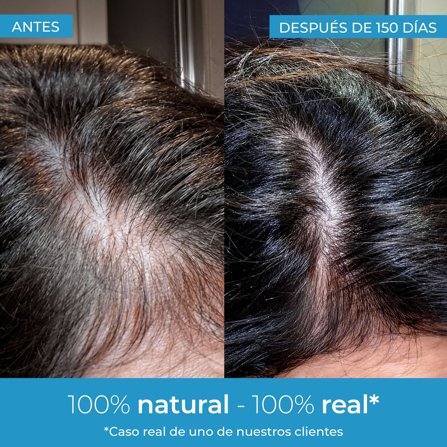 Strength Lotion pour la pousse des cheveux Arganour 50 ml