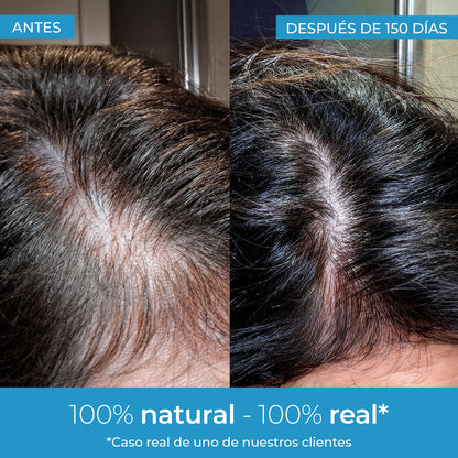 Strength Lotion pour la pousse des cheveux Arganour 50 ml