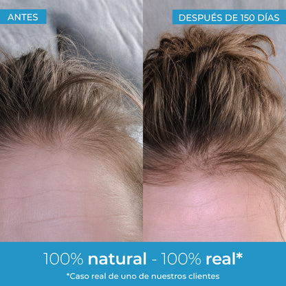 Strength Lotion pour la pousse des cheveux Arganour 50 ml
