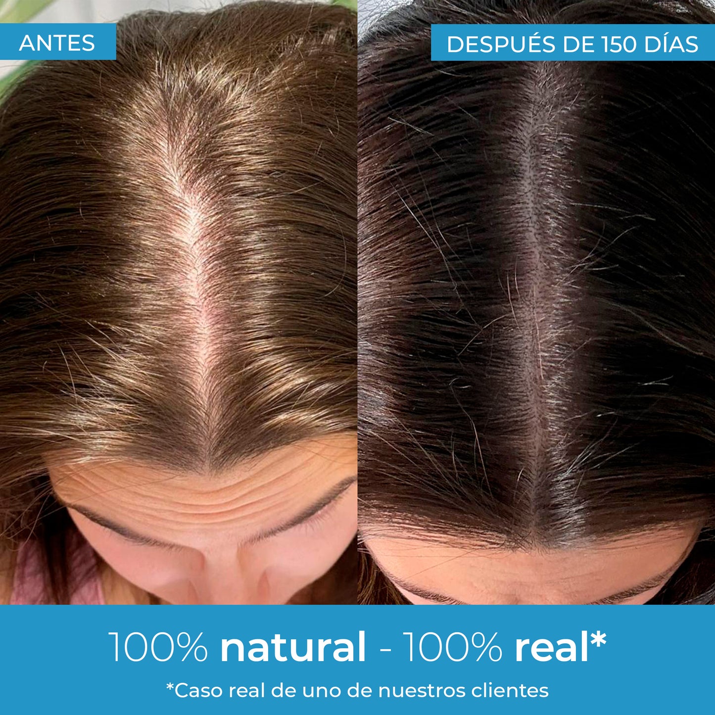 Strength Lotion pour la pousse des cheveux Arganour 50 ml