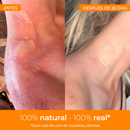 Crème réparatrice Boticream Arganour 40 ml